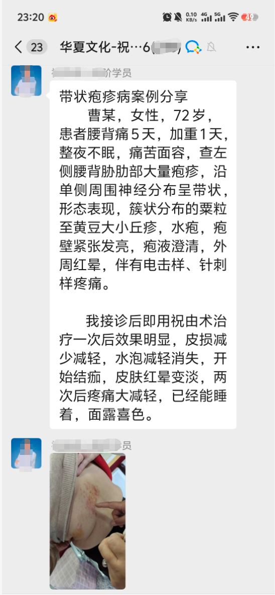 带状疱疹调理案例分享