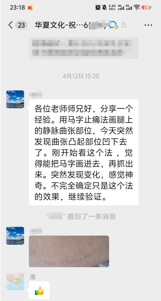 静脉曲张调理反馈